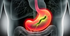 Read more about the article The fastest way to kill stomach germ/get rid of spiral microbe permanently and irreversibly